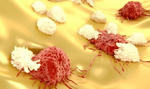 Un sistema immunitario reattivo può contrastare e distruggere le cellule tumorali 